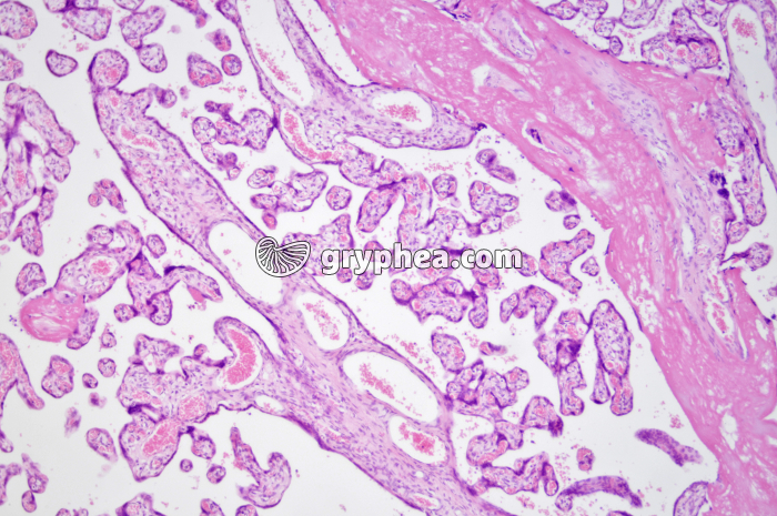 Placenta humain x25 - gryphea.com